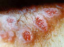 ��������� �������