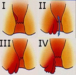 ������ �������� ��������