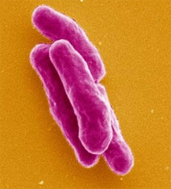 Mycobacterium tuberculosis ( )  