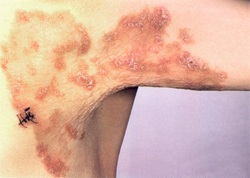 ��������� �������