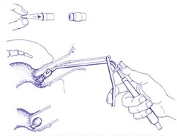 �������������� ������ ������� ��������